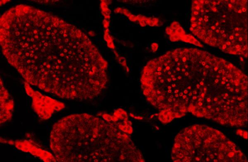 SAE1 Antibody