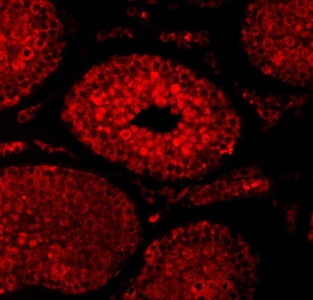 SAE1 Antibody