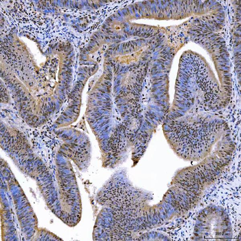 SAE1 Antibody