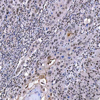 SAE1 Antibody