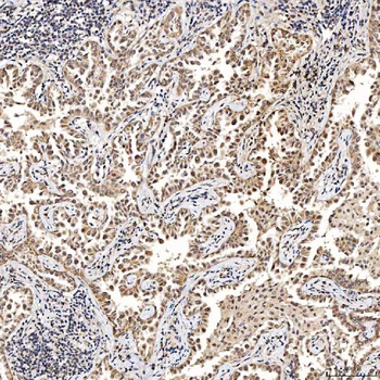 SAE1 Antibody