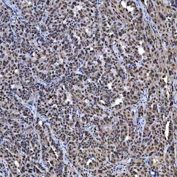 SAE1 Antibody
