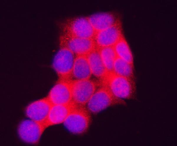 INPP4A Rabbit Polyclonal Antibody
