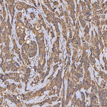 HSD11B2 Rabbit Polyclonal Antibody