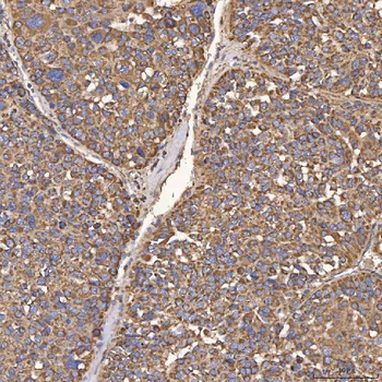 HSD11B2 Rabbit Polyclonal Antibody