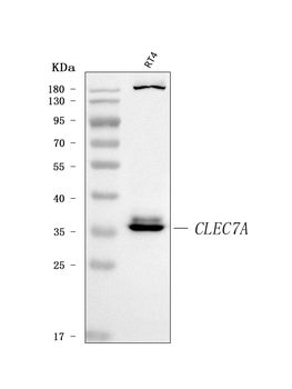 Dectin-1/CLEC7A Rabbit Polyclonal Antibody