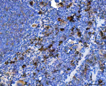 TXNDC5 Antibody