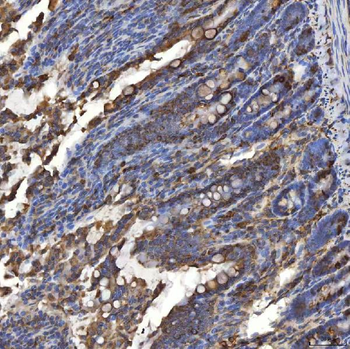 TXNDC5 Antibody