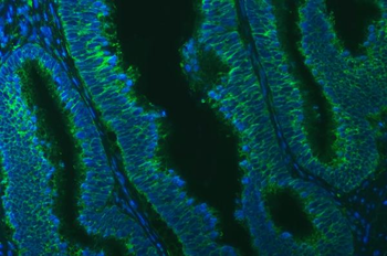 TXNDC5 Antibody