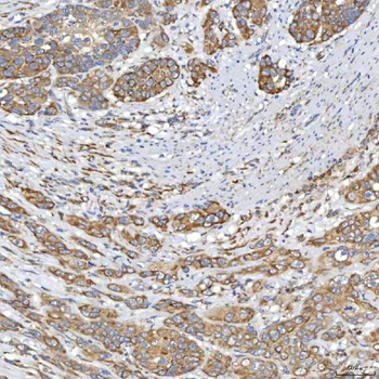 TXNDC5 Antibody