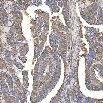 TXNDC5 Antibody