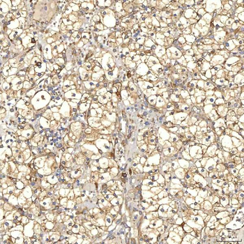 TXNDC5 Antibody