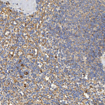 TXNDC5 Antibody