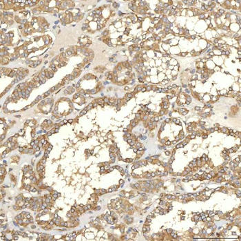 TXNDC5 Antibody