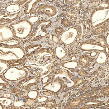TST Antibody