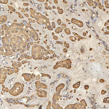TST Antibody