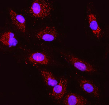 TST Antibody