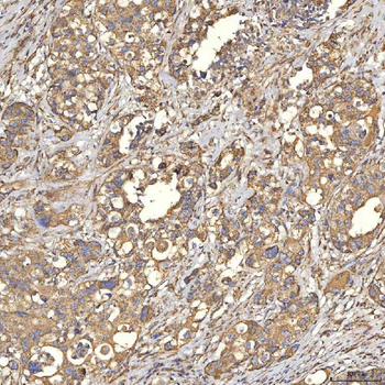 TST Antibody