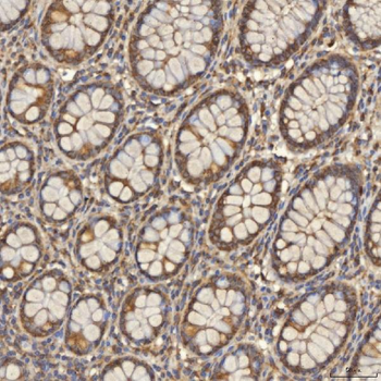 TST Antibody