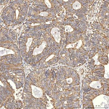 TST Antibody