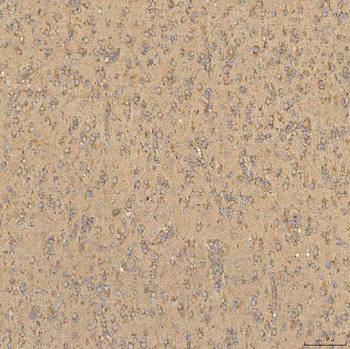 TST Antibody