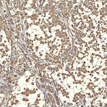 TST Antibody