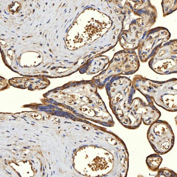 TST Antibody