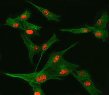 TSEN34 Rabbit Polyclonal Antibody