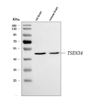 TSEN34 Rabbit Polyclonal Antibody