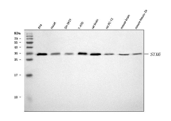 Syntaxin 6/STX6 Rabbit Polyclonal Antibody