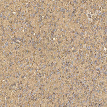 SNX4 Rabbit Polyclonal Antibody
