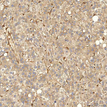 SNX4 Rabbit Polyclonal Antibody