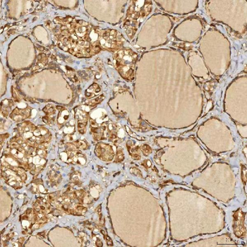 SNX4 Rabbit Polyclonal Antibody