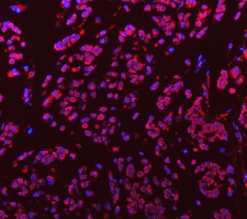 Sm-D3/SNRPD3 Antibody