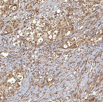 Sm-D3/SNRPD3 Antibody