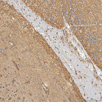 Sm-D3/SNRPD3 Antibody