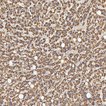 Sm-D3/SNRPD3 Antibody