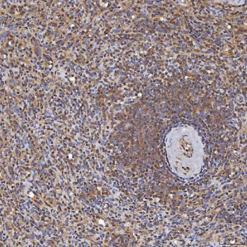 Sm-D3/SNRPD3 Antibody