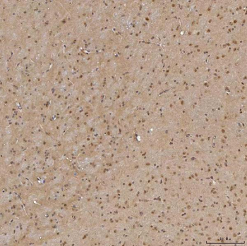 Sm-D3/SNRPD3 Antibody