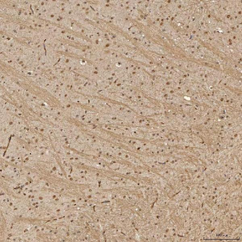 Sm-D3/SNRPD3 Antibody