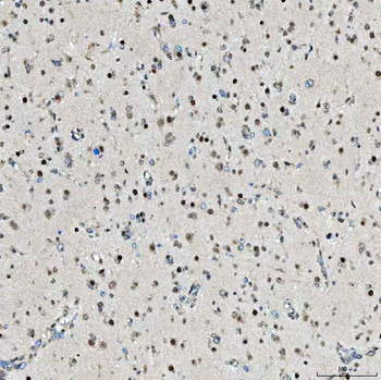 SNRPD2 Antibody