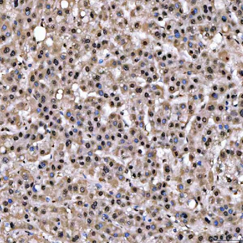 SNRPD2 Antibody