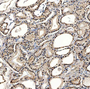SNRPD2 Antibody