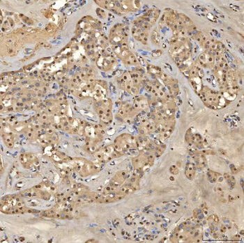 SNRPD2 Antibody