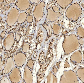 SNRPD2 Antibody