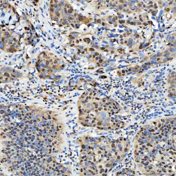 SNRPD2 Antibody