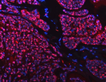 SNRPD2 Antibody