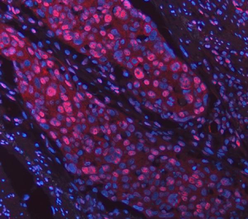 SNRPD2 Antibody