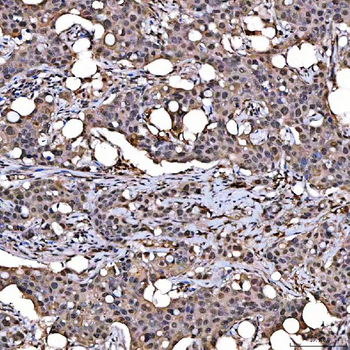 SNRPD2 Antibody