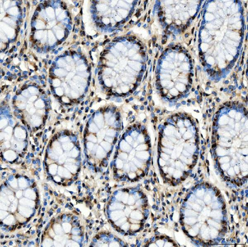 SNRPD2 Antibody